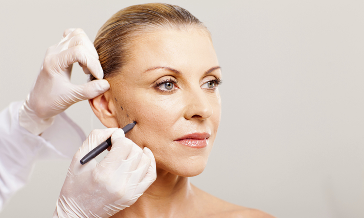 Facial Fillers In Women In Their 50s